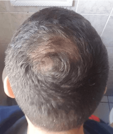 Review image 1